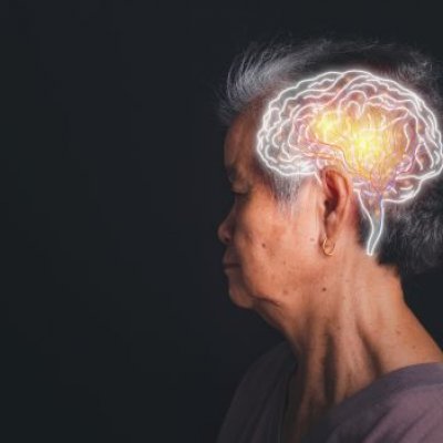 a woman with short grey hair looks to the left on a black background, a white superimposed drawing of a brain is on her head